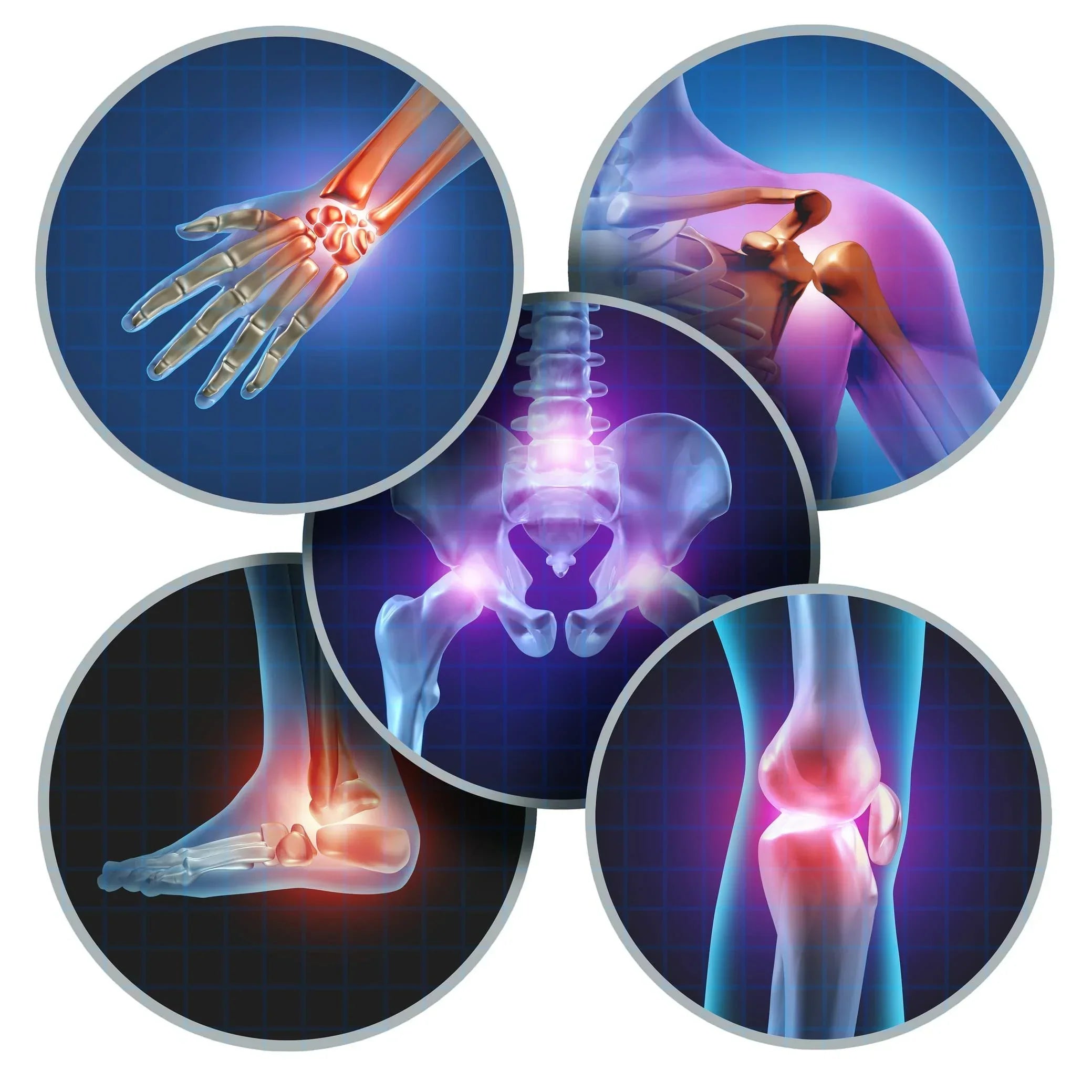 Graphic Collage of Various Joints Affected by Arthritis