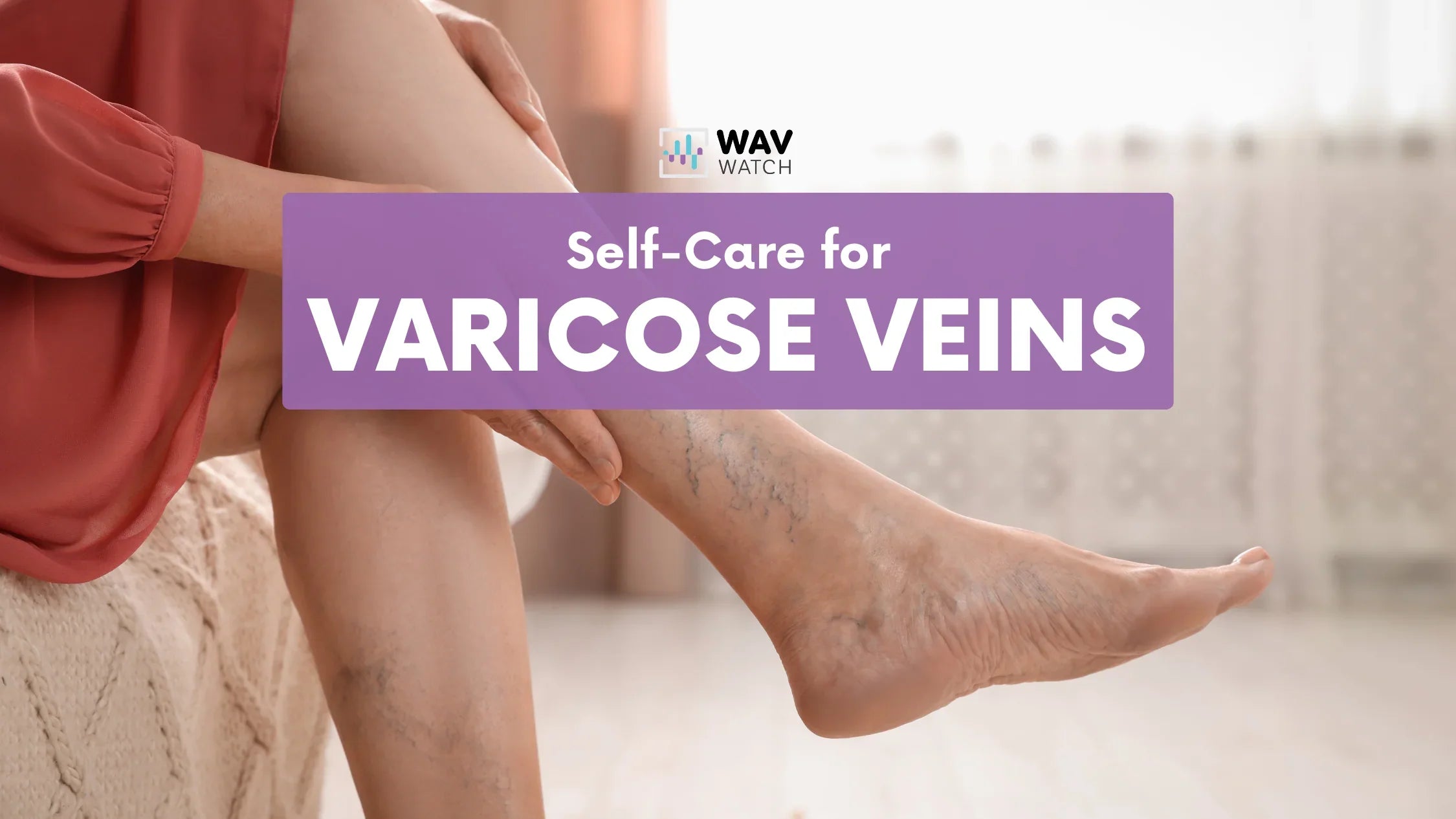 Image of Woman with Varicose Veins