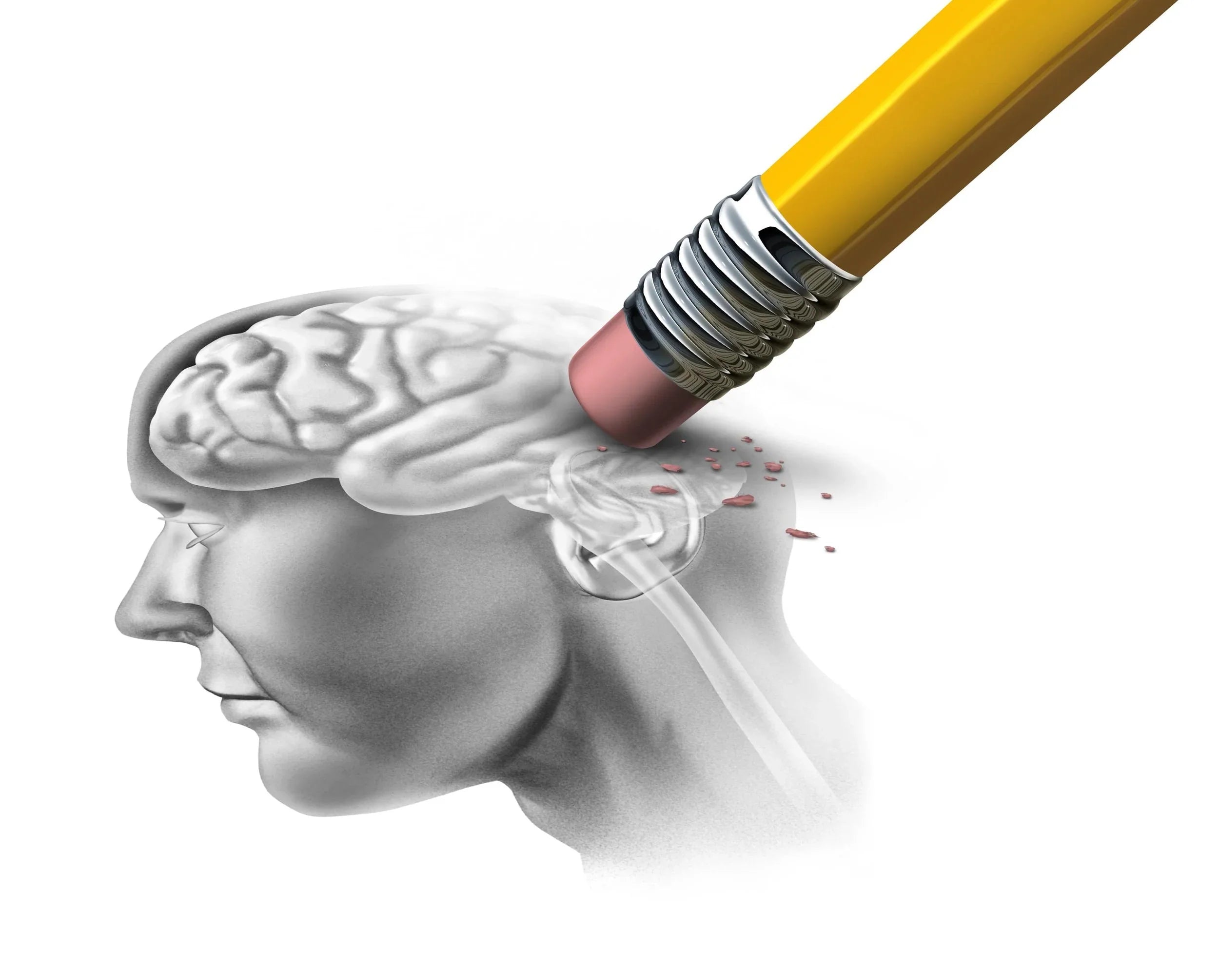 Graphic of Memory Being Erased