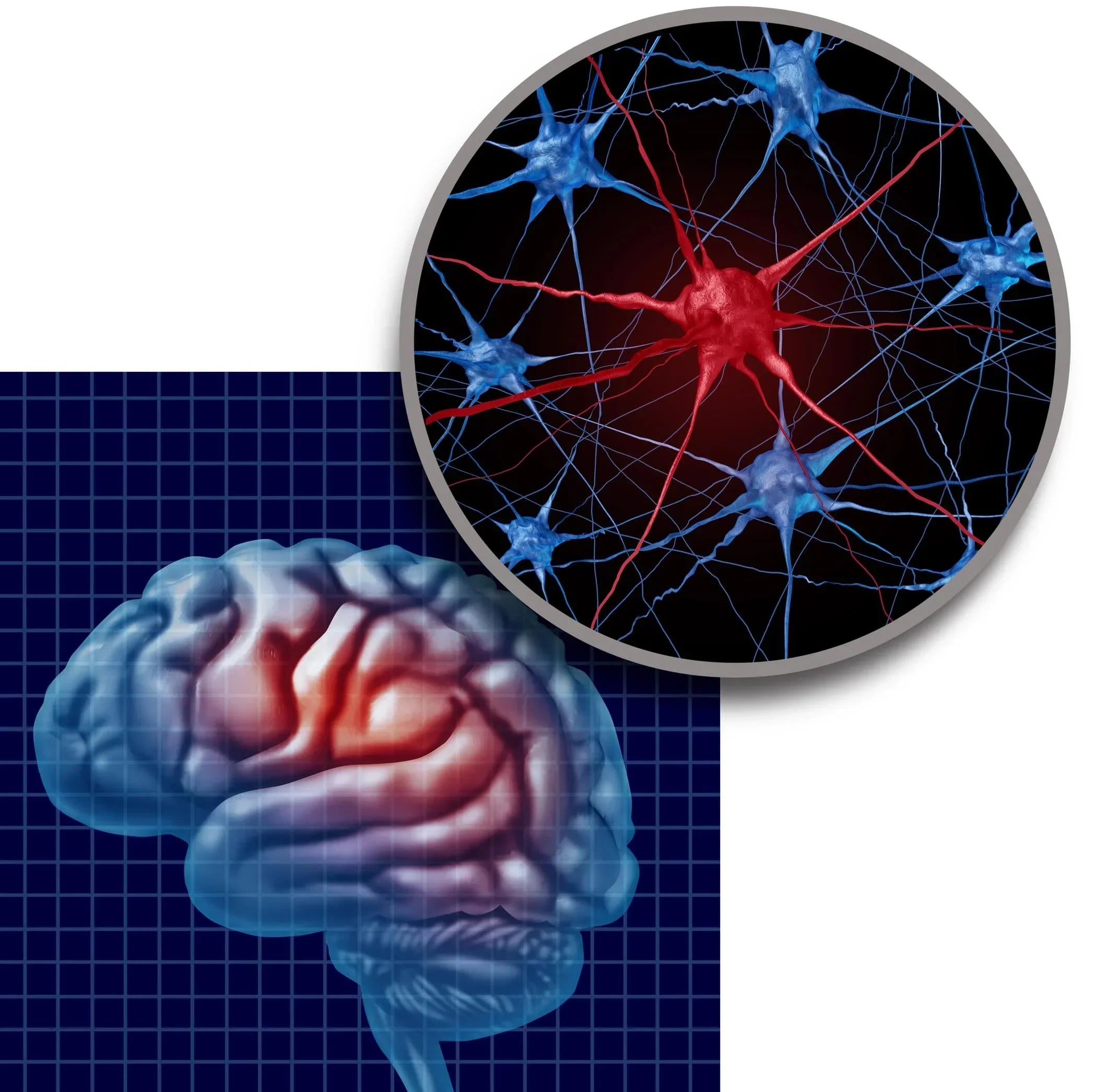 Graphic of Brain and Neurons
